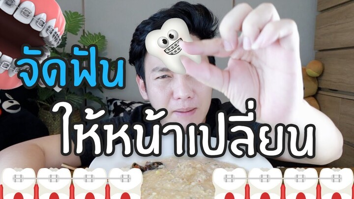 จัดฟันให้หน้าเปลี่ยนเคล็ดไม่ลับที่ต้องถอน / กินเฮียร์