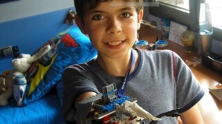 A prosthetic limb may cost tens of thousands of yuan, but Lego may only cost a few hundred?