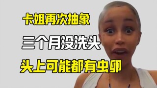 卡姐自爆三个月没洗头 头上可能有虫卵