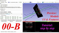 3D Slicer Lamina Landmark Labeling. #00-B. Preview -- module UI  & features