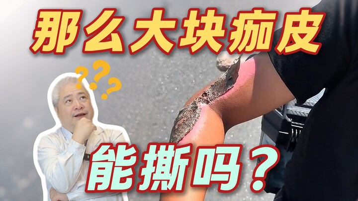 【科普】你能忍到第几秒不撕？痂皮这样处理好得快！
