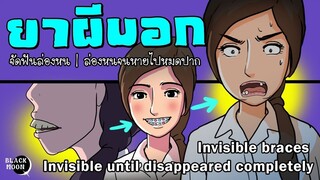 ยาผีบอกจัดฟันล่องหนล่องหนจนหายไปหมดปาก