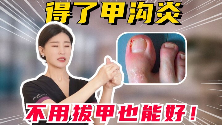 Mắc viêm kẽ móng mà không cần nhổ móng vẫn khỏi được!