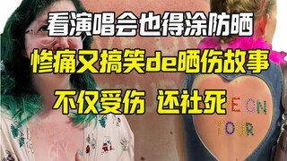 粉丝看演唱会没涂防晒 不仅晒伤还社死