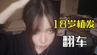 لقد قمت حقًا بزراعة الشعر