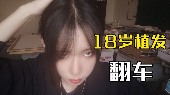 我 真 的 植 过 发