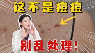 มีจุดแดงเล็กๆ ขึ้นที่หน้าอกและหลัง นี่อาจไม่ใช่สิว อย่าสับสนอีกต่อไป!