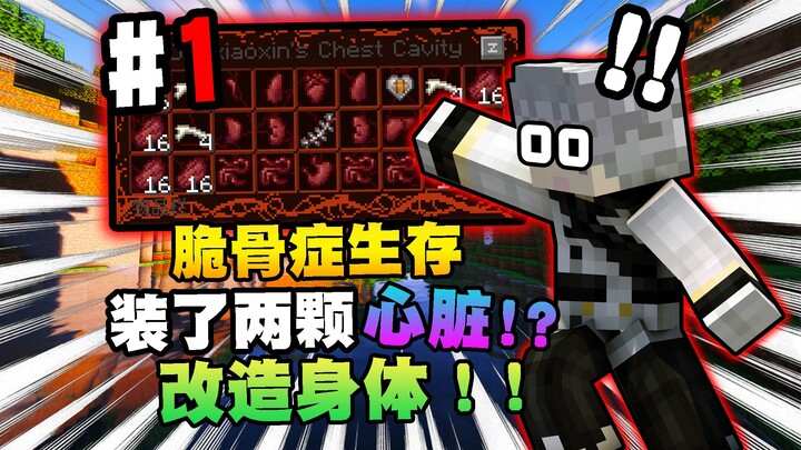 [Living with Osteogenesis Imperfecta] Modifying Your Body Using Monster Organs!? Starts with Two Hea