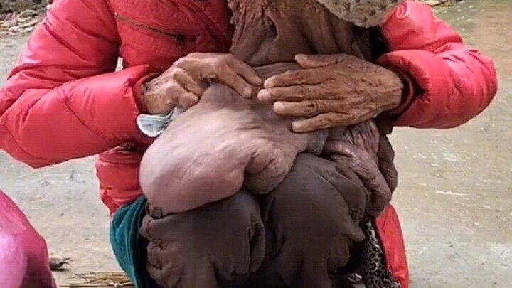 A rope breaks at its weakest point; poor are those who suffer from illness.