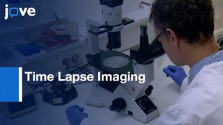 Time Lapse Imaging of Macrophage Chemotaxis | Protocol Preview