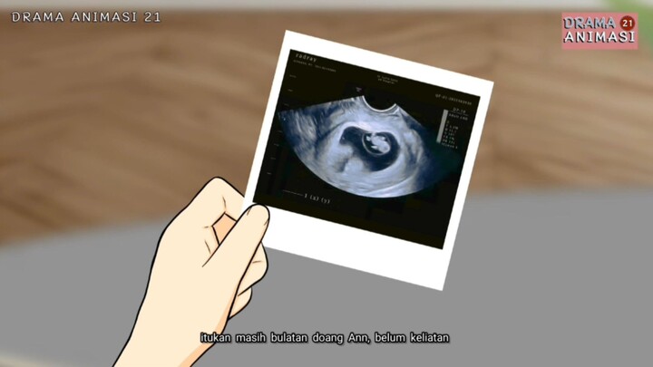 PASUTRI OJOL DAN BULE MAU PUNYA ANAK PART 32 - Drama Animasi 21