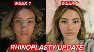 RHINOPLASTY UPDATE