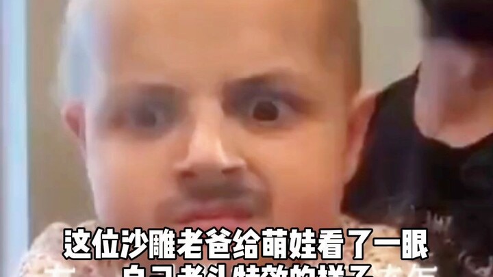 Amazing: A cute baby shows a rare evolutionary regression, suddenly growing a tail