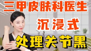 Top-tier doctor deeply immersed in treating joint darkening.