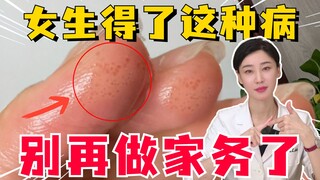 女生得了这种病就不要做家务了！