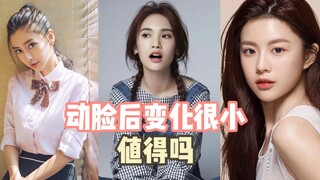 التغيير بعد عملية تجميل الوجه ضئيل جدًا، فهل يستحق ذلك؟