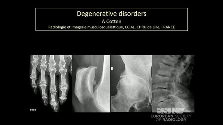 Degenerative joint Radiology