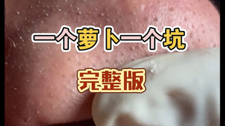 สิวไขมันบนผิวแห้ง จัดการได้ตรงจุด
