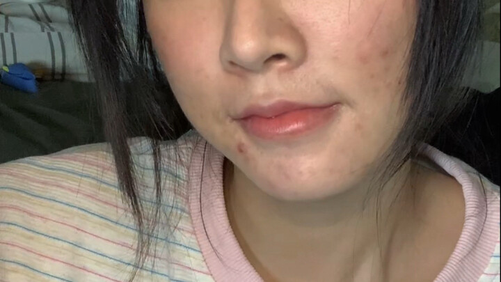 "سأذهب لفحص الأمراض الجلدية وفحص الرئتين"