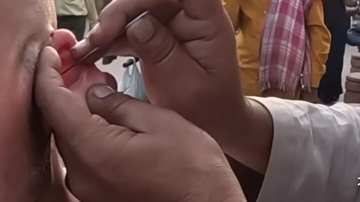 Bule asal luar negeri mencoba perawatan telinga di India, tiba-tiba terdengar suara petasan yang nya