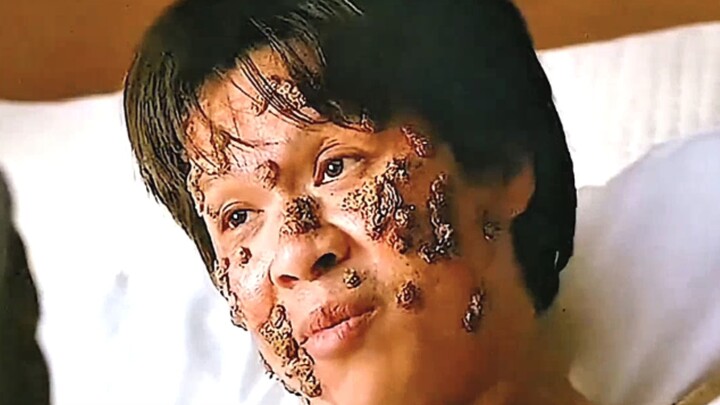 A man has contracted a strange illness, and his body is now covered in tree branches.