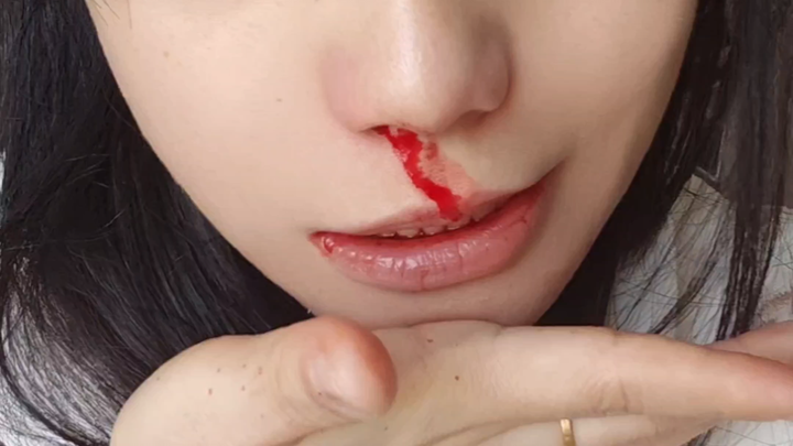 لقد أفرطتُ في تناول المنشطات، وأنفي ينزف. أشعر بانخفاض في تشي ودمي مؤخرًا، لذا تناولتُ بعض الجينسنغ.