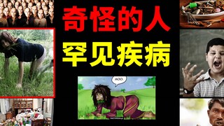 【高能】奇怪的人类：怪病大赏