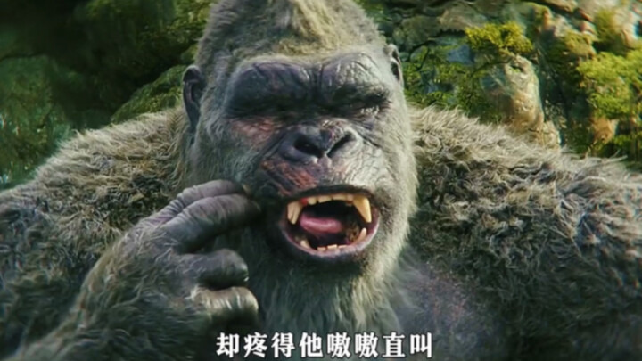 Berapa biaya untuk mengganti gigi berlubang si King Kong?