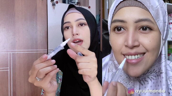 Cobain Pemutih Gigi Praktis dari Beaudelab, SEAMPUH APA???