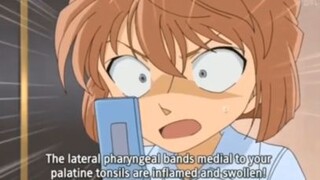 Conan bị ỐM - Haibara lo lắng ra mặt nè | Haibara troll Conan