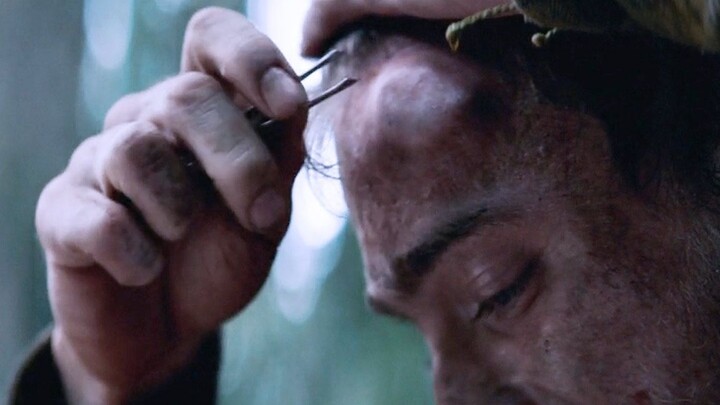 Young man survives alone in the wilderness, develops a massive abscess on his head—cuts it open and 