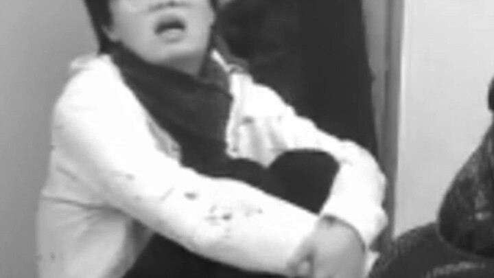 Răng khôn buồn bã lung lay