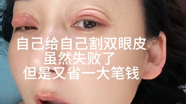 “Zhi Ren TV” mengorek kelopak mata sendiri, meski gagal tapi hemat biaya, hihi