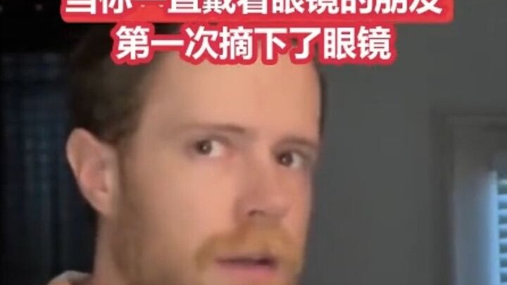 Teman yang pakai kacamata akhirnya melepas kacamatanya...