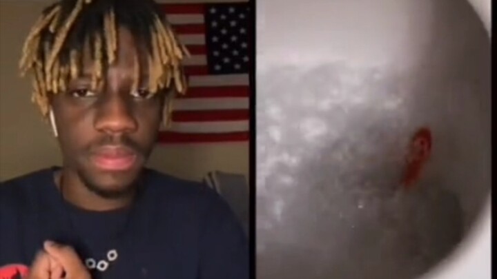 Bro?