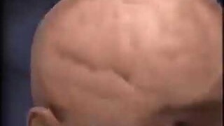 Brain Aneurysm Fart Meme