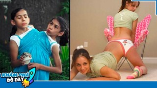 6 Cặp Song Sinh Dính Liền Nhau Độc Lạ và Bí Ẩn Nhất Thế Giới...Xem Rồi Mới Dám Tin Là Thật