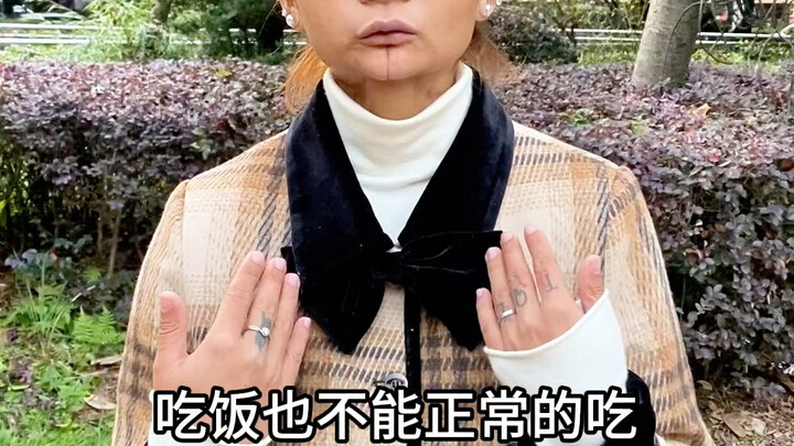 24 tahun, usia yang indah seperti bunga, tapi sudah mengunyah sirih pinang selama delapan tahun. Lid