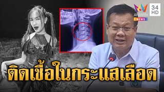 แพทย์แจง ผิง ชญาดา เสียชีวิตเพราะติดเชื้อในกระแสเลือด | ข่าวเที่ยงอมรินทร์ | 9 ธ.ค. 67