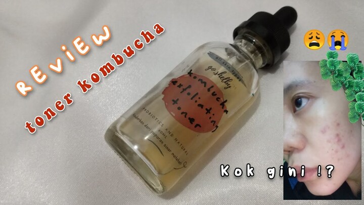 Toner Viral !! Review Toner Kombucha go Shelby   (1 bulan pemakaian)