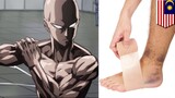 Ikuti olahraga ala One Punch Man, kaki pria alami cedera - TomoNews