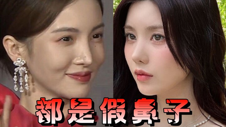 Mereka berdua punya hidung palsu, mengapa hidungnya terlihat lebih baik?