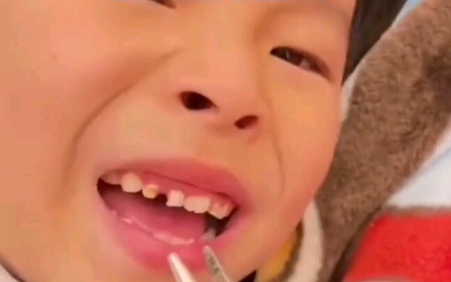 แม่ถอนฟันให้ลูก ดูแล้วฉันปวดฟันไปด้วย…