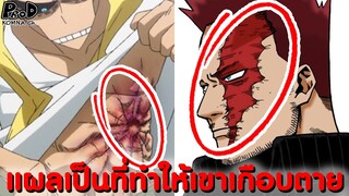 My Hero Academia - ที่มาของแผลเป็นที่ทำให้ฮีโร่เกือบตายได้มายังไง? [KOMNA CHANNEL]