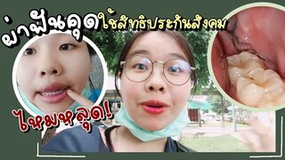 รีวิว ผ่า-ถอนฟันคุด (ไหมหลุด)ครั้งแรก howtoใช้ประกันสังคม ความรู้ใหม่ๆเยอะมาก | ikziice 💦