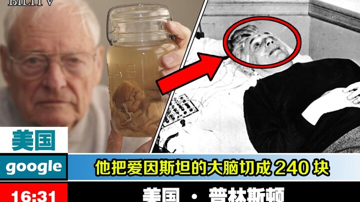 [เปิดเผย] ความจริงสุดช็อก หลังสมองไอน์สไตน์ถูกขโมยและตัดออกเป็น 240 ชิ้น!