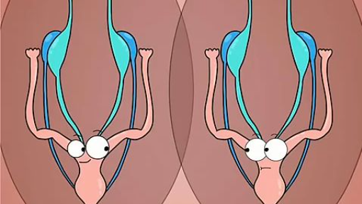 How Twins Became A Boy And A Girl