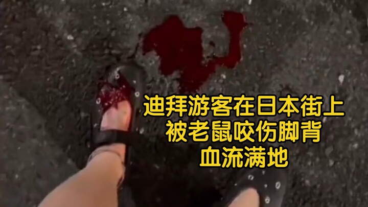Dubai tourist bitten on the foot by a rat on a Japanese street—blood everywhere!