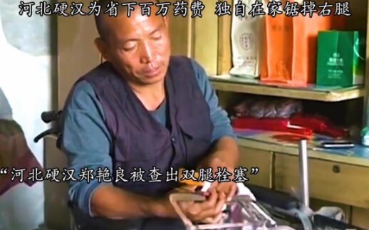 เซิ่งเยี่ยนเหลียง ชายแกร่งวัย 48 ปีจากเหอเป่ย ตัดขาขวาของตัวเองที่บ้านเพียงลำพัง เพื่อประหยัดค่ารักษ