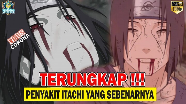 TERUNGKAP !!! INILAH PENYAKIT YANG DIDERITA ITACHI UCHIHA SELAMA INI - [FAKTA&TEORI]